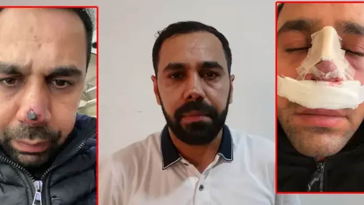 Foto - Nefes darlığı şikayetiyle gitmişti: Burun ameliyatı hayatını karardı