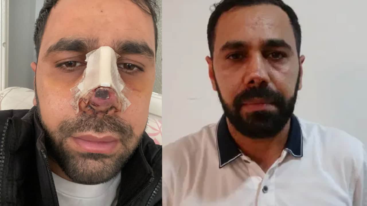 Nefes darlığı şikayetiyle gitmişti: Burun ameliyatı hayatını karardı