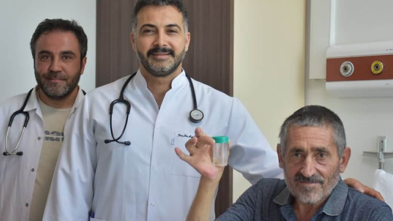 Foto - Nefes darlığı ve öksürük rahatsızlığıyla hastaneye gitti: Akciğerinden sarımsak çıktı... Film gibi olay!