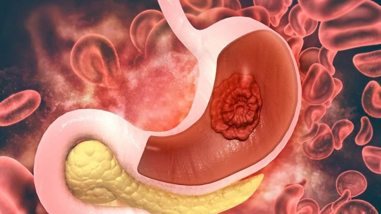 Foto - O içeceklerin kanser riskini artırdığı ortaya çıktı: Nedenini duyanlar kulaklarına inanamıyor