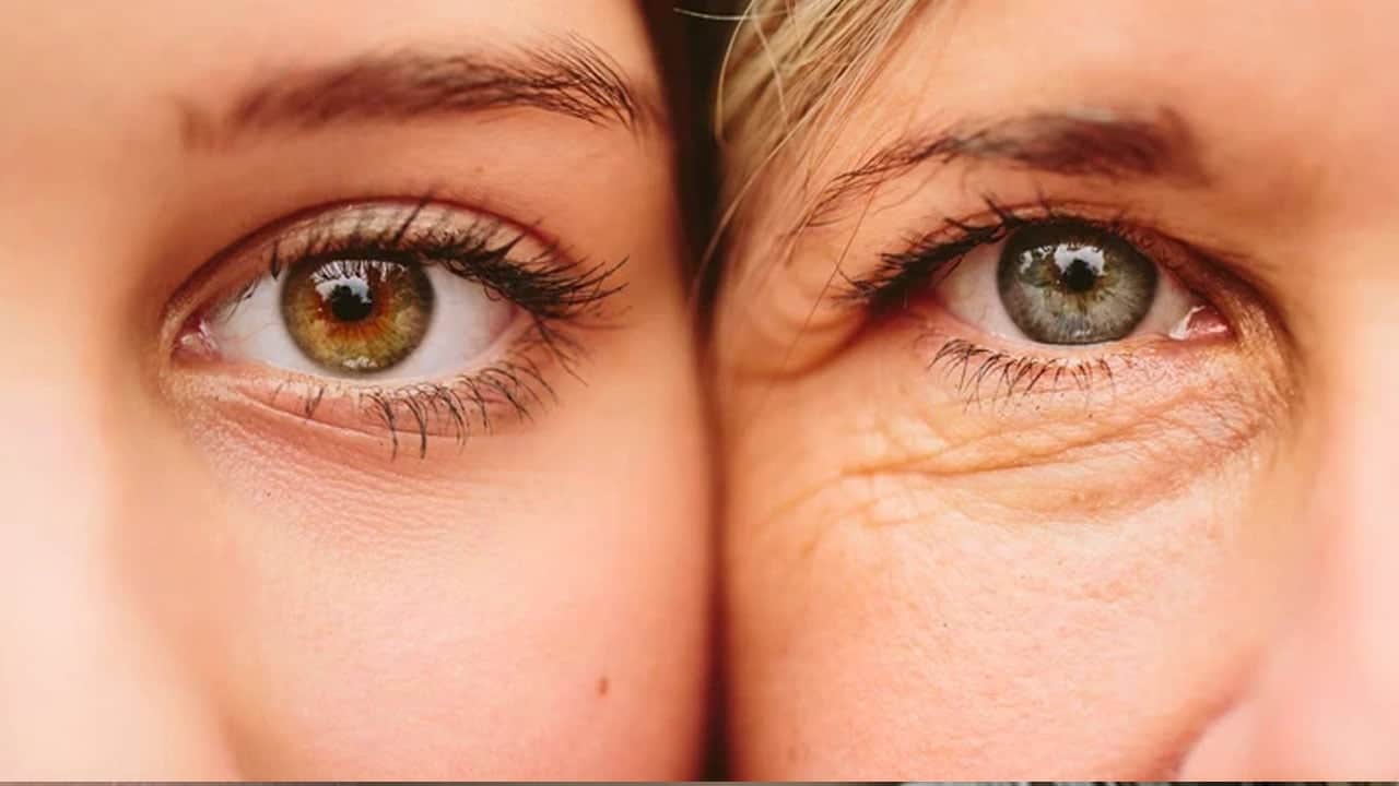 Foto - Okuyunca inanamayacaksınız! Cilt kuruyor... Kış aylarında cildi yaşlandıran hatalar! Hızlı kilo alıp veriyorsanız...