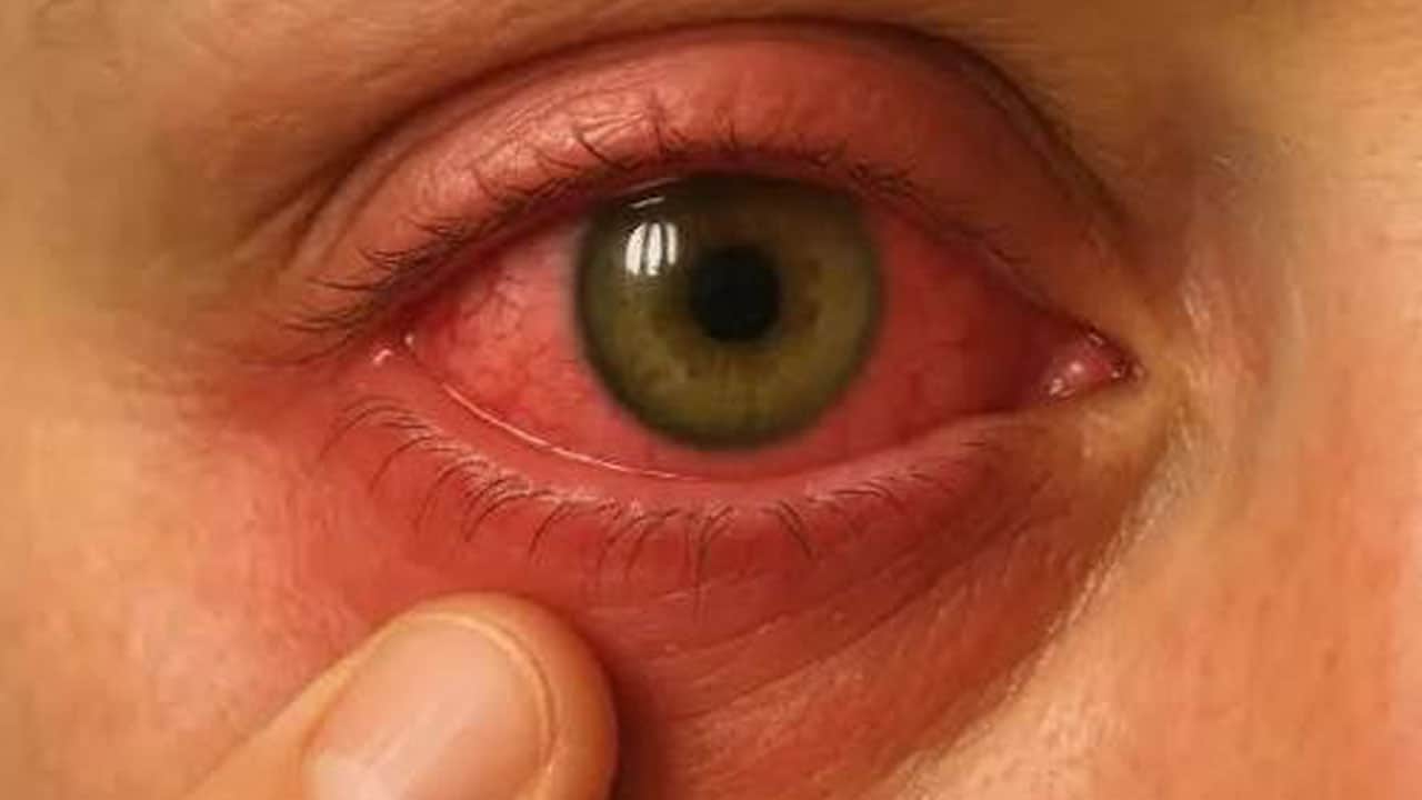 Foto - Onlarca kişi dava açtı! Zayıflama iğnesi oldular, görme sorunu yaşamaya başladılar