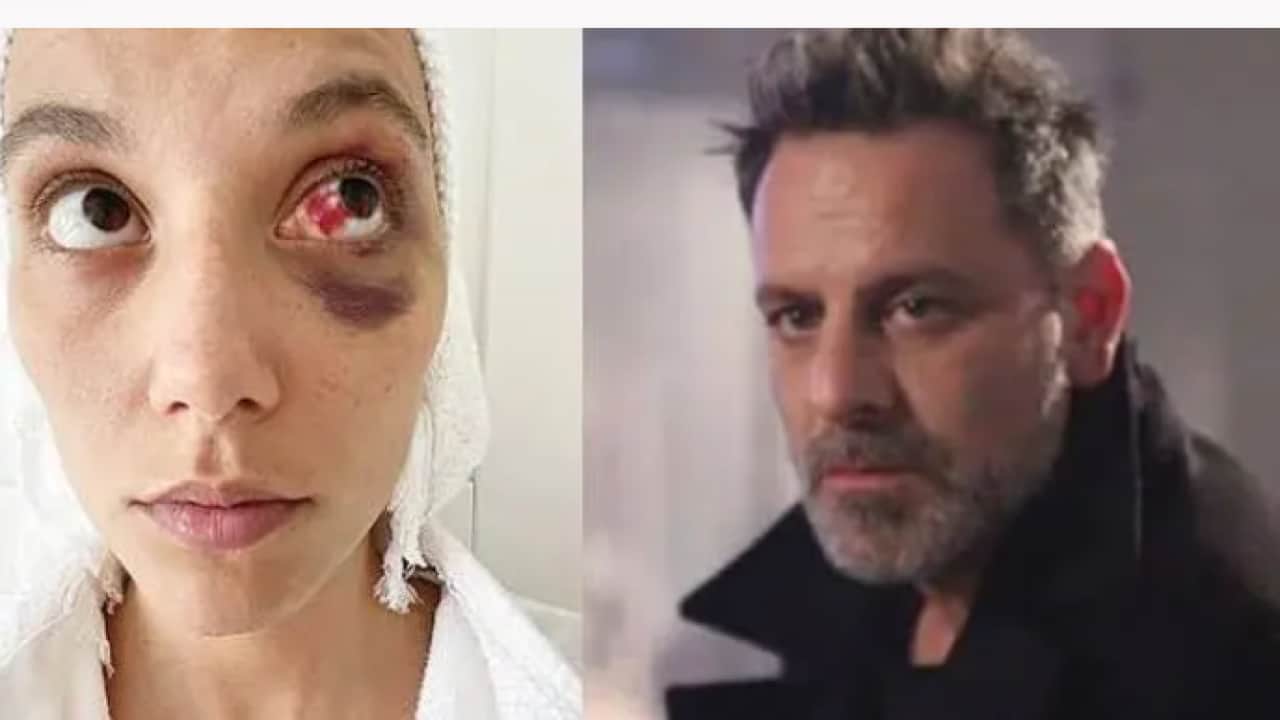 Foto - Ozan Güven neler yaşadığını itiraf etti: 'Annem bu yüzden Alzheimer oldu'