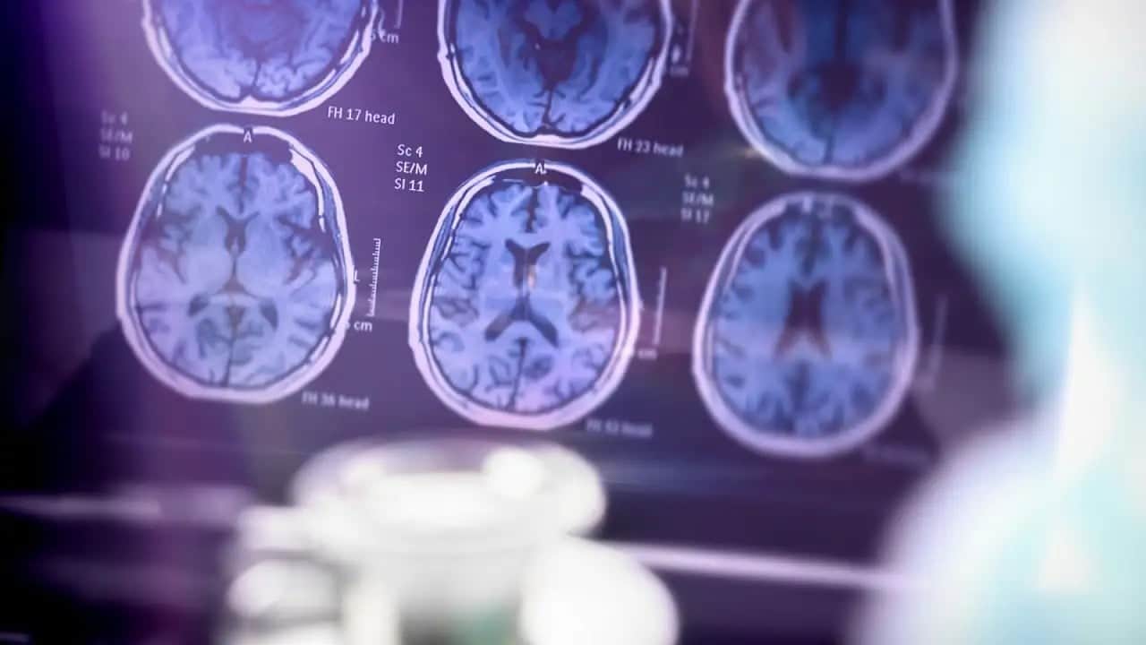 Foto - Sağlık Bakanlığı’ndan çok kritik Alzheimer uyarısı! Sakın yaşlılığa bağlayıp geçmeyin!