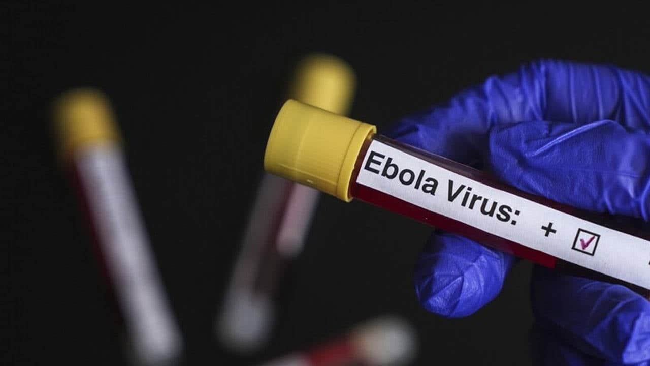 Foto - Salgın işgalcilere sıçradı: Terör devletine Ebola şoku