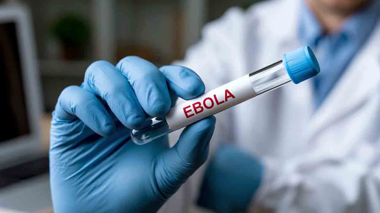Foto - Salgın işgalcilere sıçradı: Terör devletine Ebola şoku