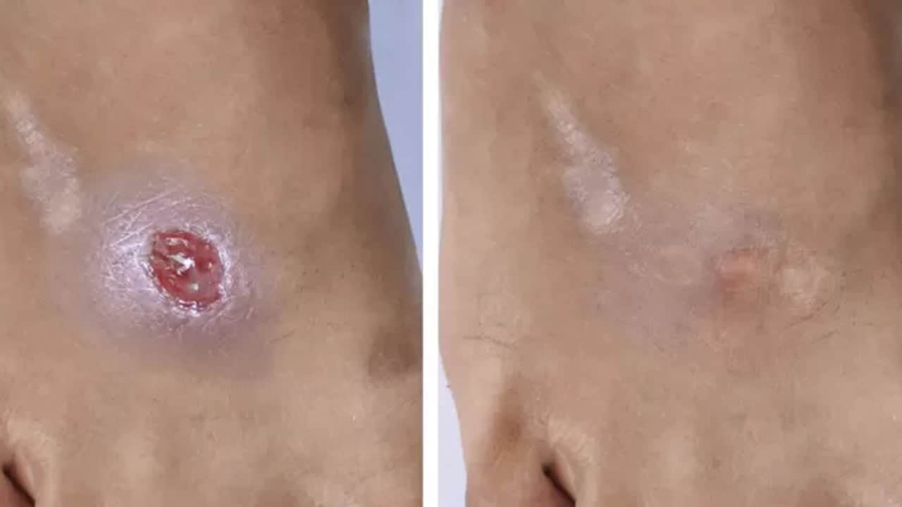 Foto - Şeker hastalığı sinsi ilerliyor: Bu belirtiler varsa sakın ihmal etmeyin! Erken teşhis büyük önem taşıyor
