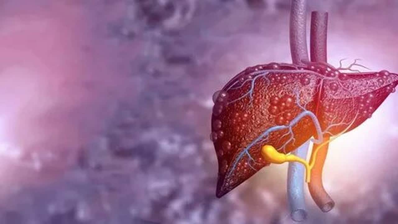 Foto - Sessiz tehlike kapımızda! Karaciğerimizi içten içe kemiriyor!