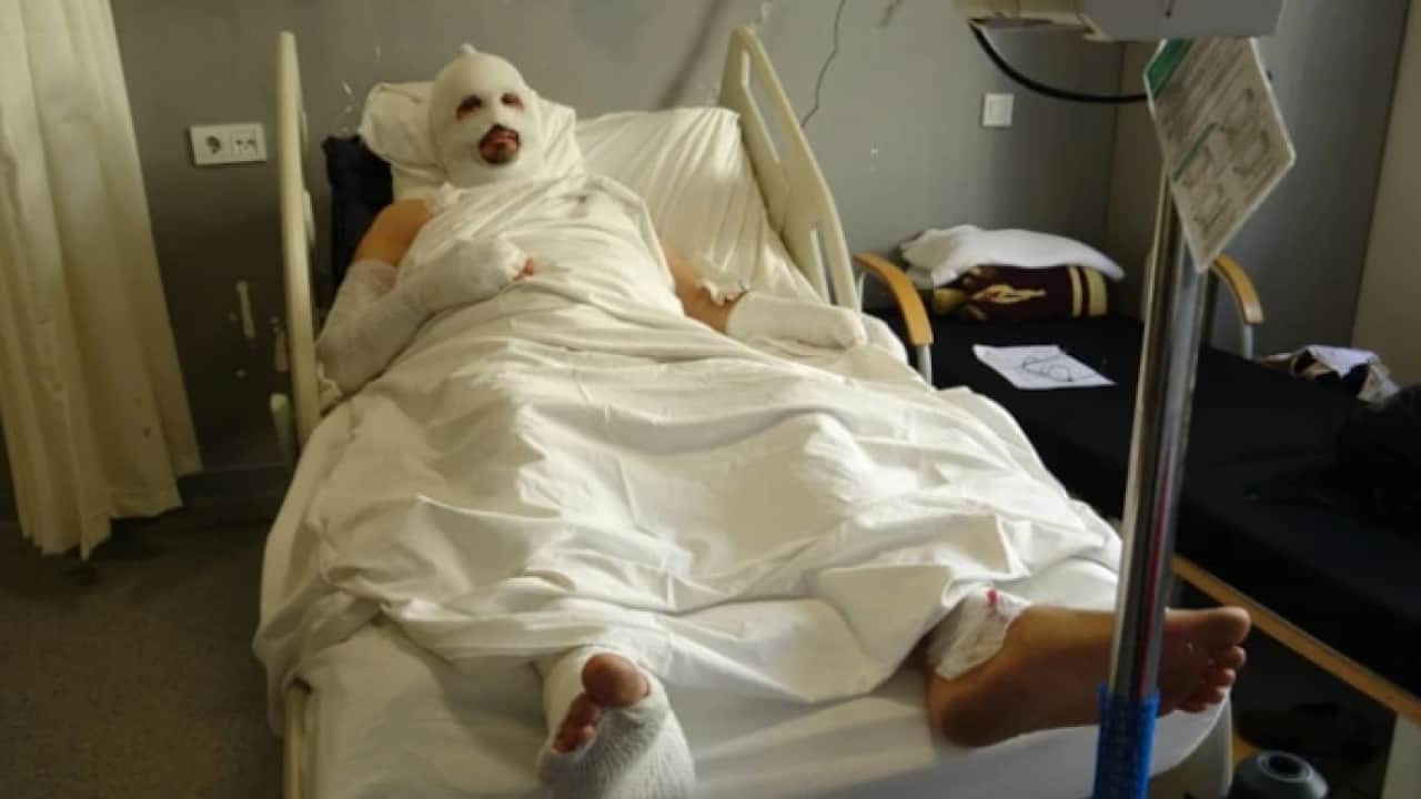 Foto - Telefon ve televizyon aynı anda patladı: Ailesini kurtarmak isterken yandı!