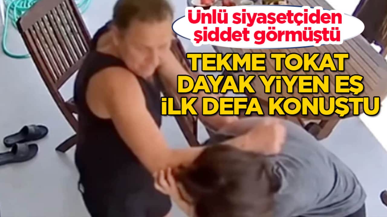 Ünlü siyasetçiden şiddet görmüştü! Tekme tokat dayak yiyen eş, ilk defa konuştu
