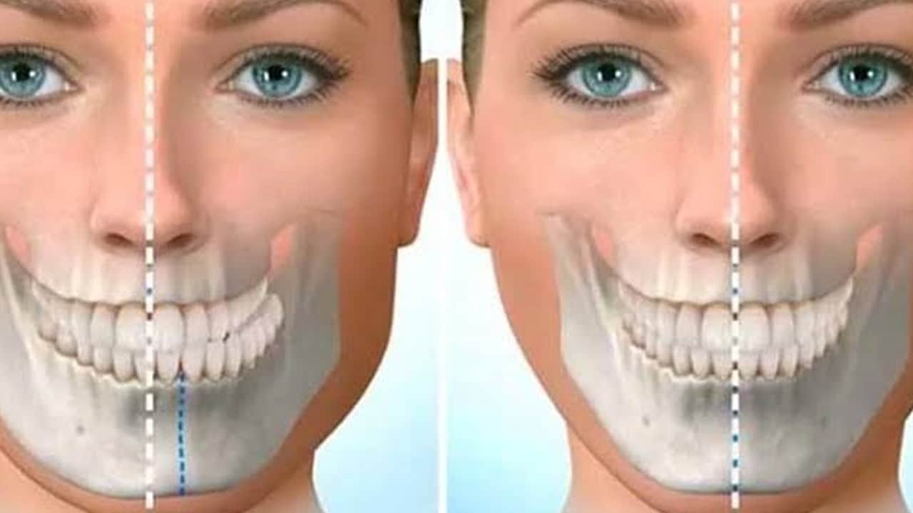 Foto - Uzmanı uyardı: Çene ağrıları önemli... Sakız çiğnemek gibi doğru duruş alışkanlıklarına da dikkat! Zararlı...