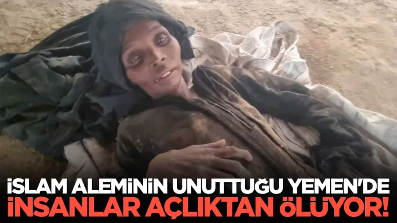 İslam aleminin unuttuğu Yemen'de insanlar açlıktan ölüyor!
