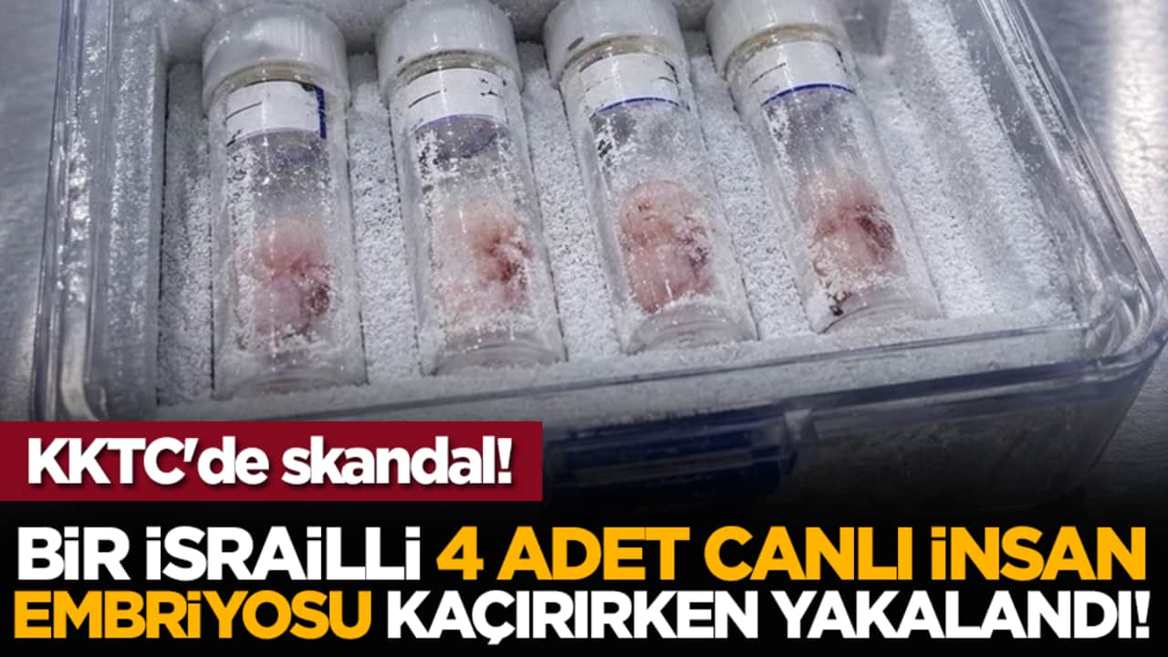 KKTC'de skandal! Bir İsrailli 4 adet canlı insan embriyosu kaçırırken yakalandı!