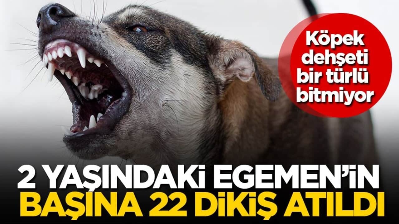 Köpek dehşeti bir türlü bitmiyor! 2 yaşındaki Egemen’in başına 22 dikiş atıldı