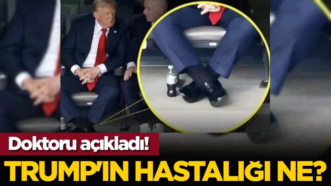 Trump'ın hastalığı ne? Doktoru açıkladı!