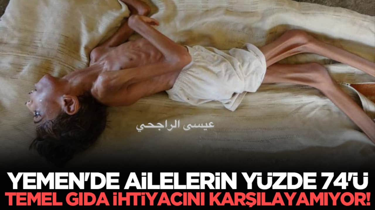 Yemen'de ailelerin yüzde 74'ü temel gıda ihtiyacını karşılayamıyor!