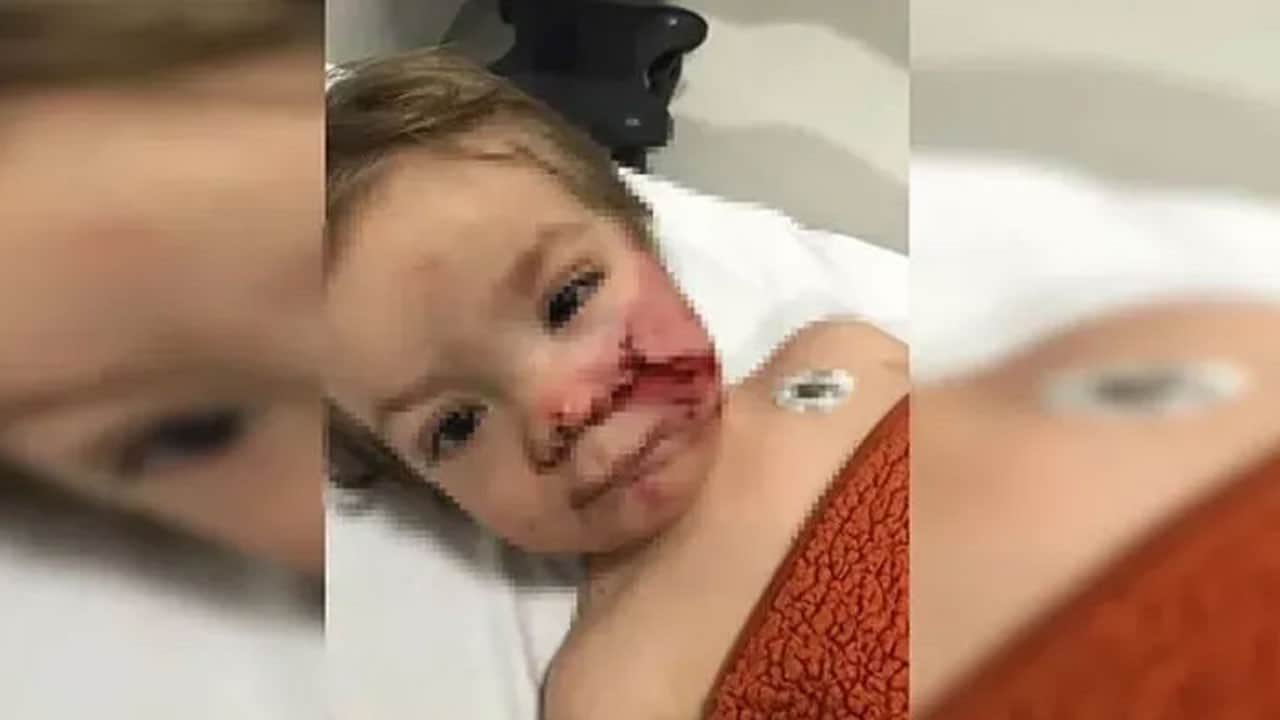 Ankara’da pitbull dehşeti! Yasaklı ırk 2 çocuğu yaraladı