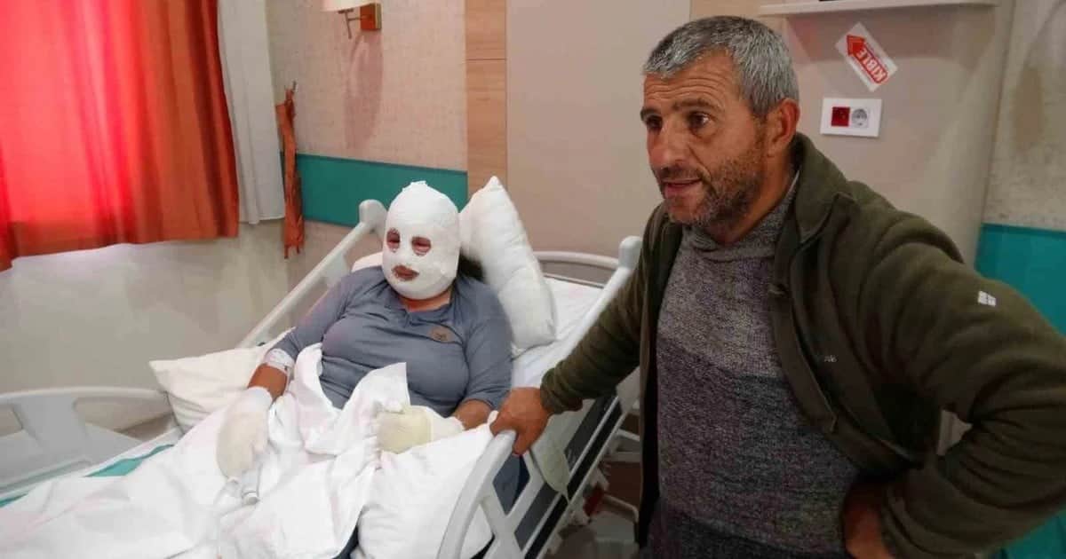 Ardahan'da anne, ağıldaki yangından 6 yaşındaki kızını kurtarırken kendisi de yandı