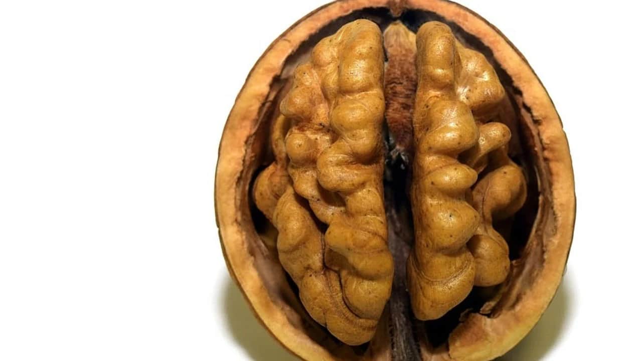 Bu besin 4 saat içinde damarları temizliyor: Herkes peşinde! Onlarca kişi yaptı! Vitamin seviyesi yüksek