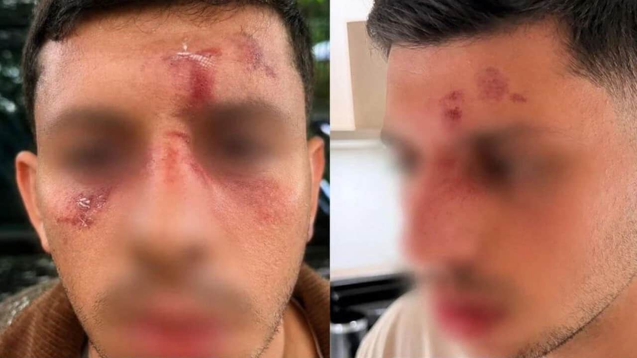 Hiçbir yerde rahat edemeyecekler: Londra'da Siyonist Yahudiye meydan dayağı