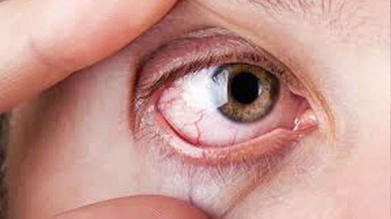 Hücre saati geri sarılıyor: Glokomda kayıp görme artık geri getirilebilir