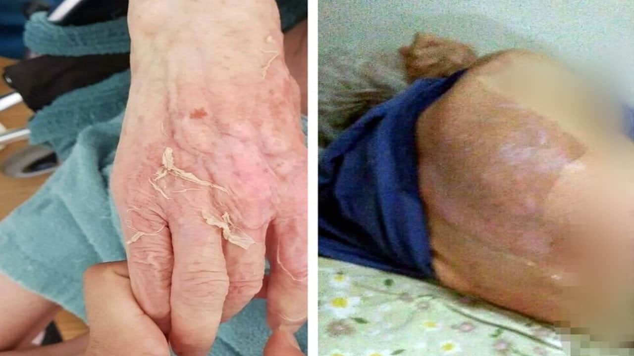 Huzurevinde kaynar su ile banyo sonrası ölümle 6 taksitle 21 bin lira ceza