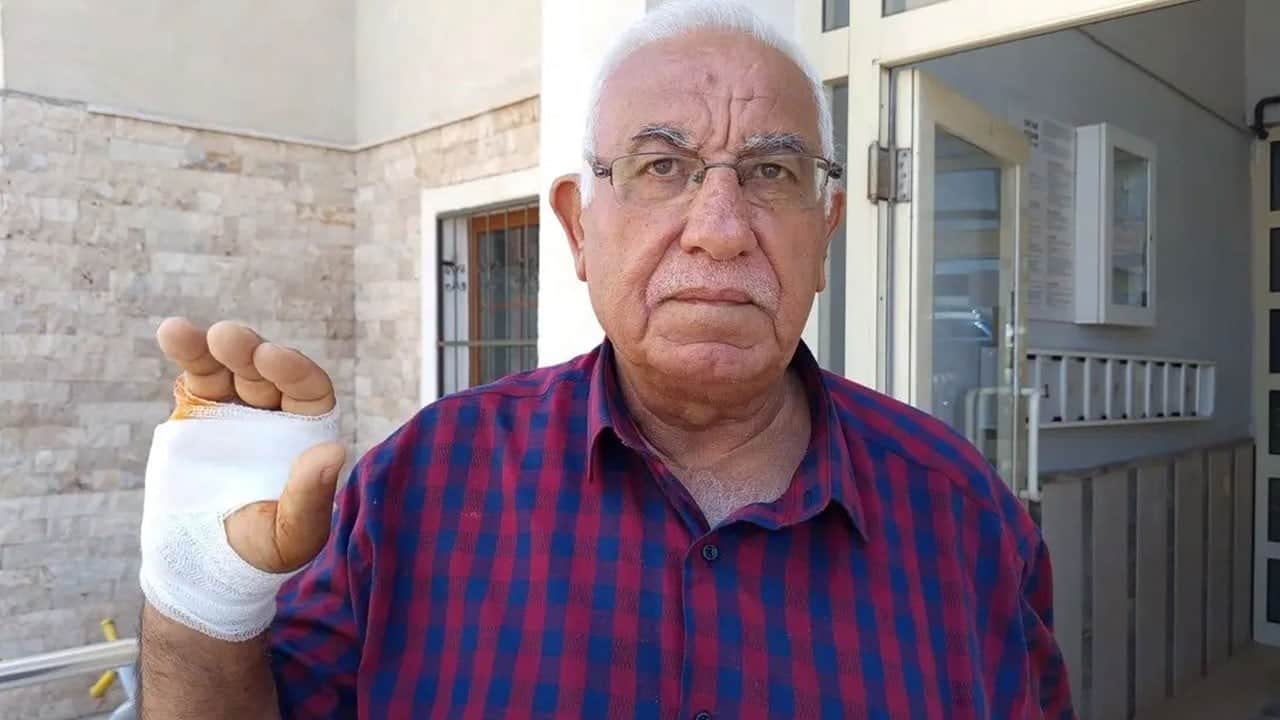 Komşusu parmağını ısırarak kopardı: Onu çok severdim!