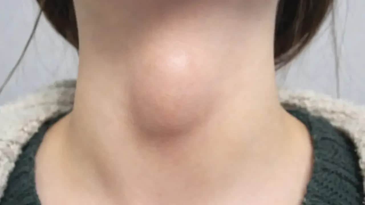 Kulağınızdaki tehlikeye dikkat! Her gün taktığınız o cihaz tiroidi vuruyor!