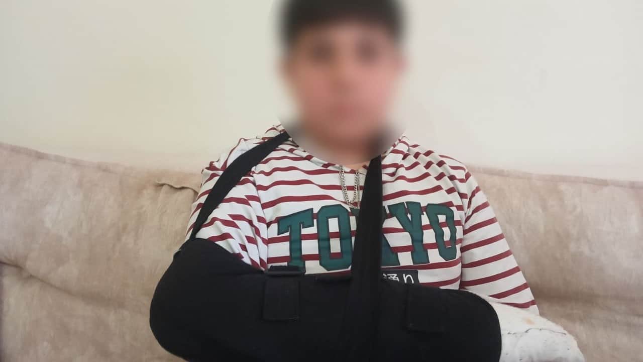 Ne oluyor bu çocuklara! 15 yaşındaki çocuk, 5.sınıf öğrencisinin parmağını kırdı