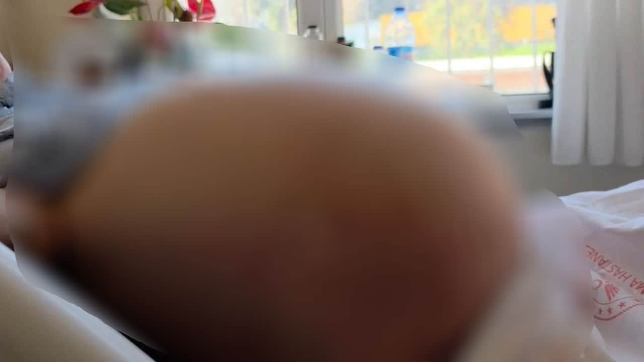 Neredeyse boğazına kadar çıkacaktı! Kabızlık sandı, karnı hamile göbeğine döndü