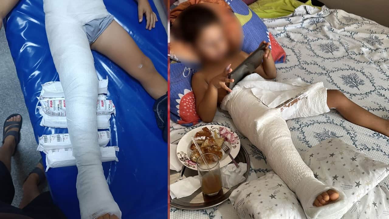 Okul bahçesinde dehşet! 4 yaşındaki çocuğun ayağı ve bacağı kırıldı