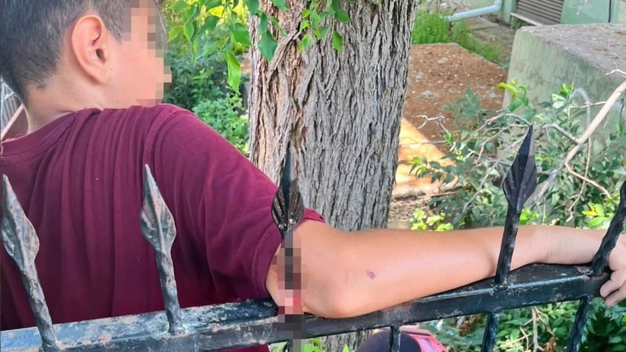 Ortaokulda şok! Öğrencinin koluna korkuluk demiri saplandı
