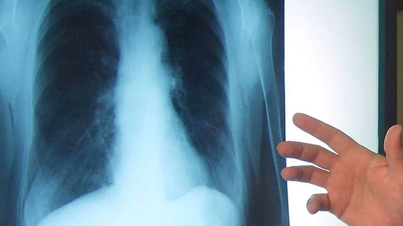 Sakın görmezden gelmeyin! Bu hastalık sinsice ilerliyor