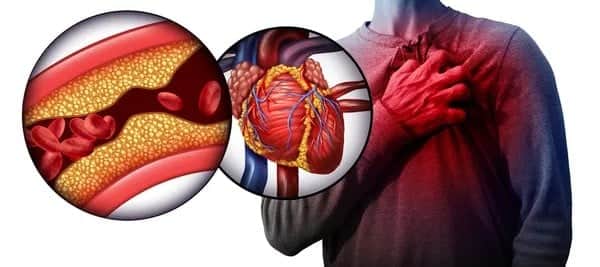 Sinsi düşman yağ değil, türüymüş! Kolesterolde ezber bozan gerçek