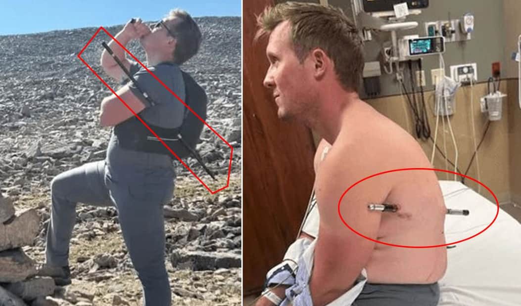  Talihsiz dağcının inanılmaz kurtuluşu: Gövdesini delen sopayla 16 kilometre yürüdü