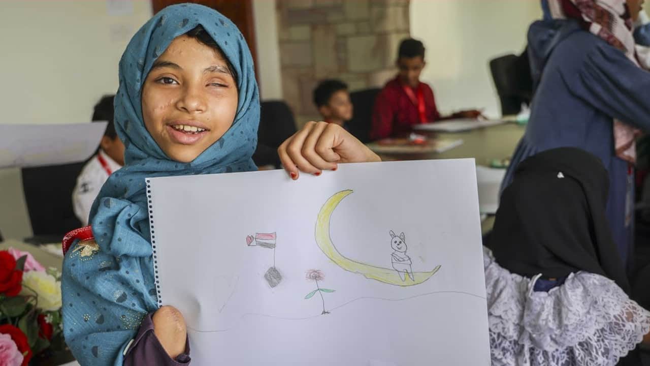 Yemen’de savaşın gizli kalmış kurbanları