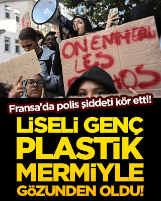 Fransa'da polis şiddeti kör etti!
