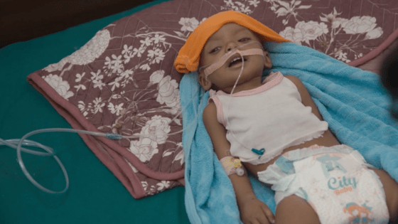 Yemen'de çocuklar ölümün eşiğinde!