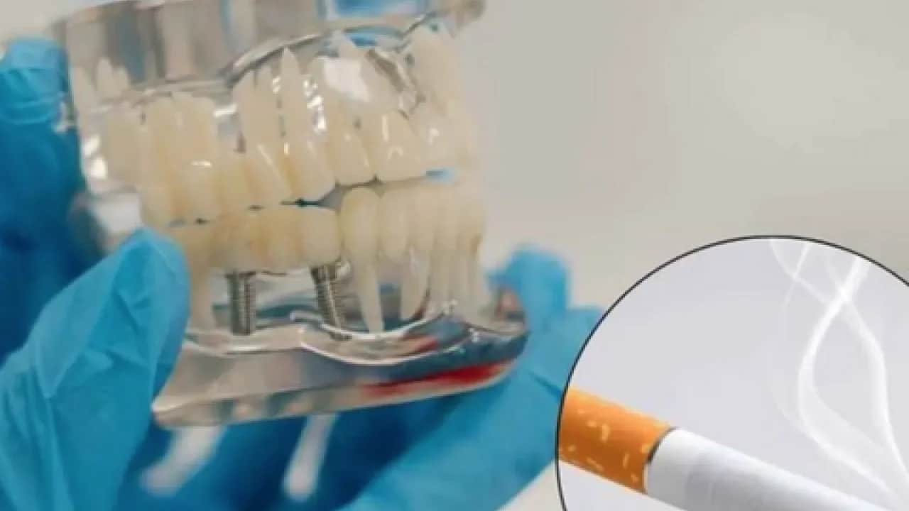 18 yaşından 85 yaşına kadar... Sigara implant kaybının en büyük nedenlerinden biri