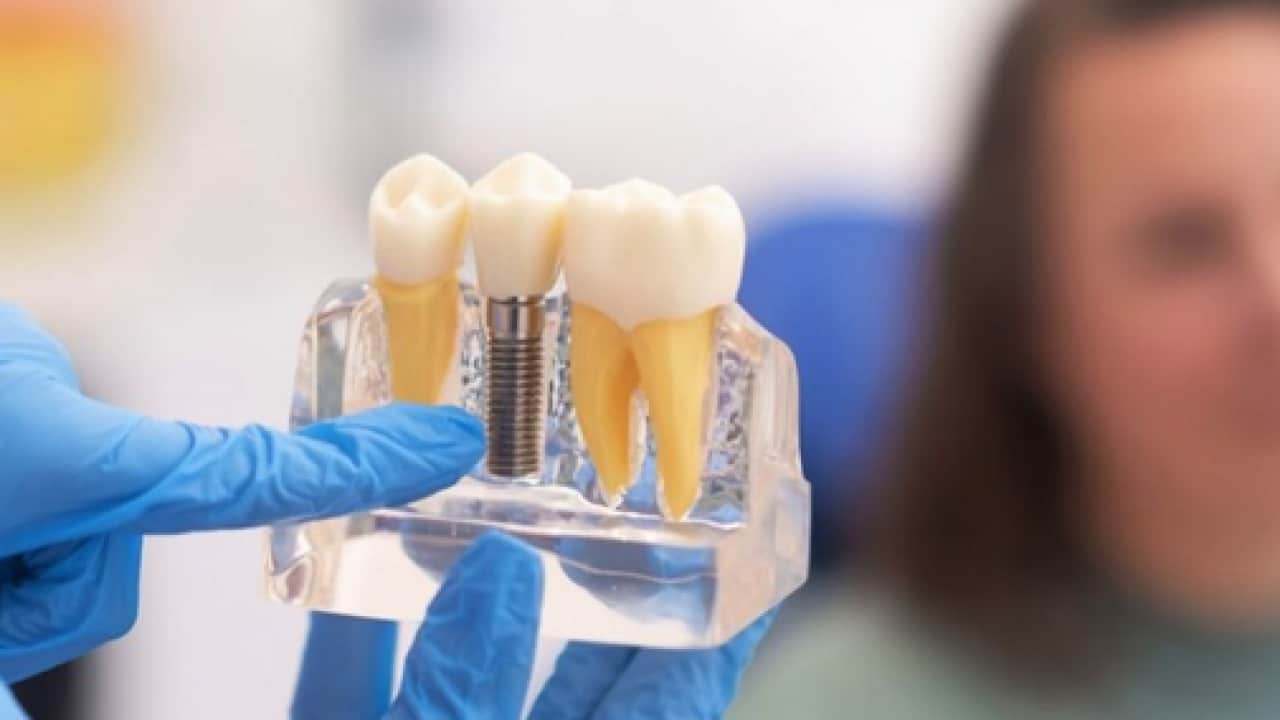 Foto - 18 yaşından 85 yaşına kadar... Sigara implant kaybının en büyük nedenlerinden biri