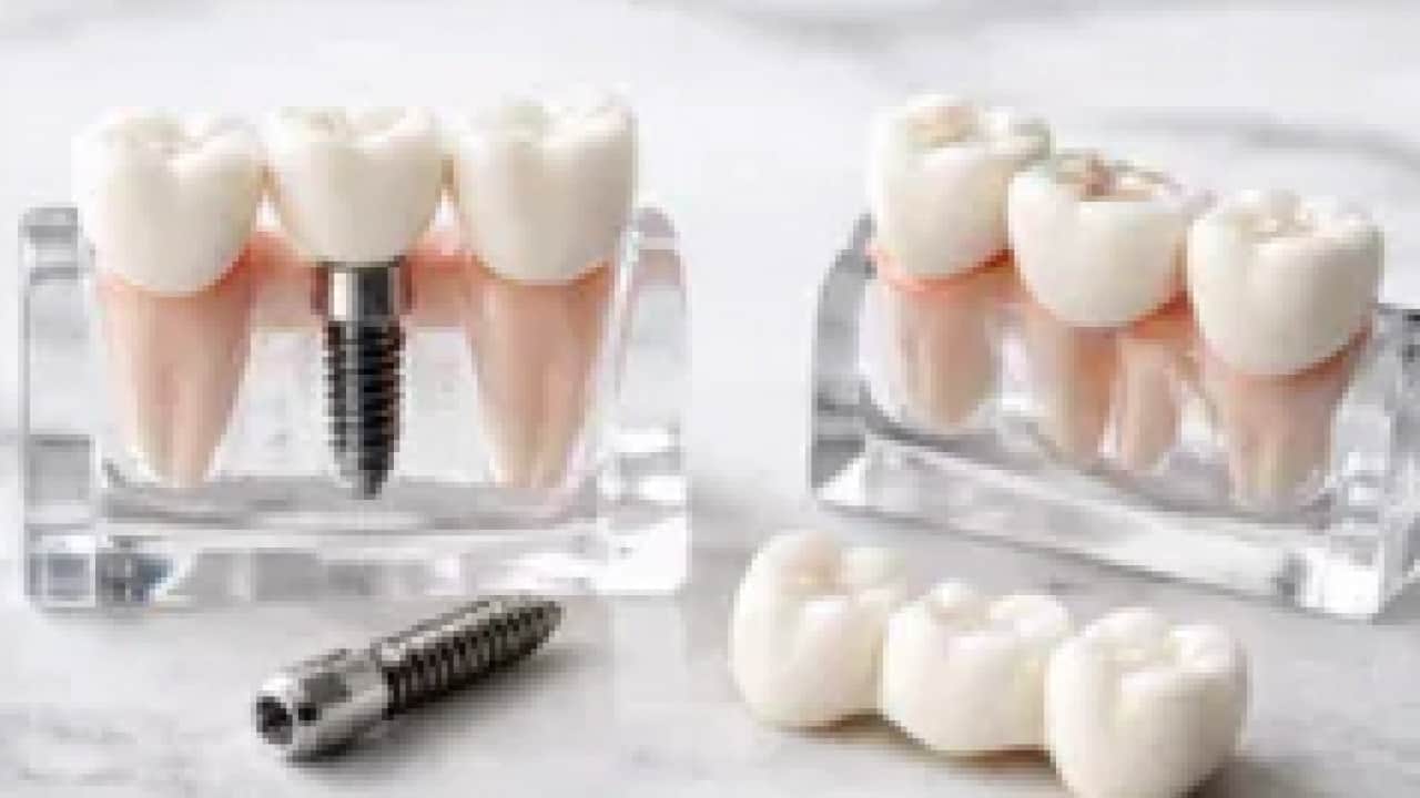 Foto - 18 yaşından 85 yaşına kadar... Sigara implant kaybının en büyük nedenlerinden biri