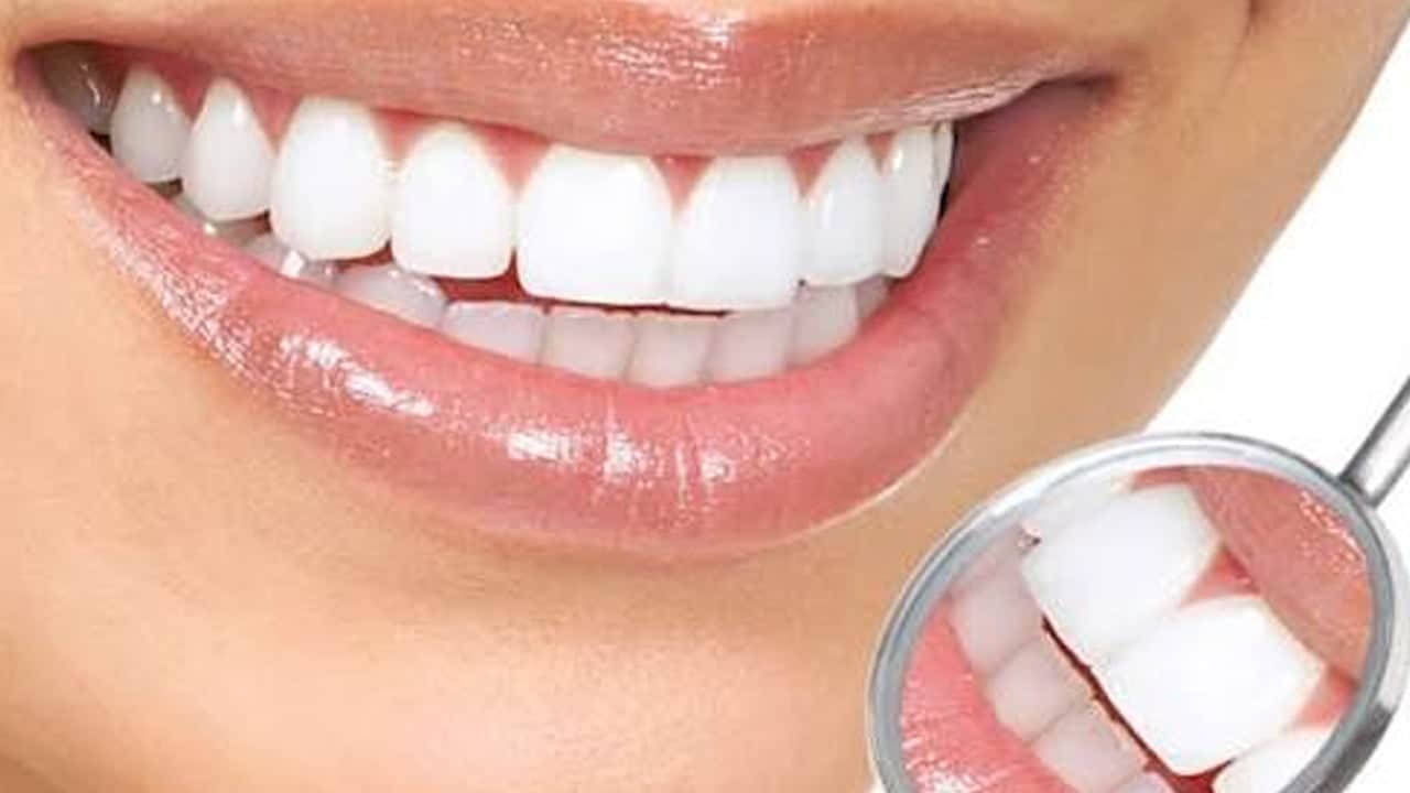 Foto - 48 saat boyunca etkiler: Sadece dişler değil ağız kokusu sorunları yaşayanlar: Kurtulmak için bu adım destek olacak