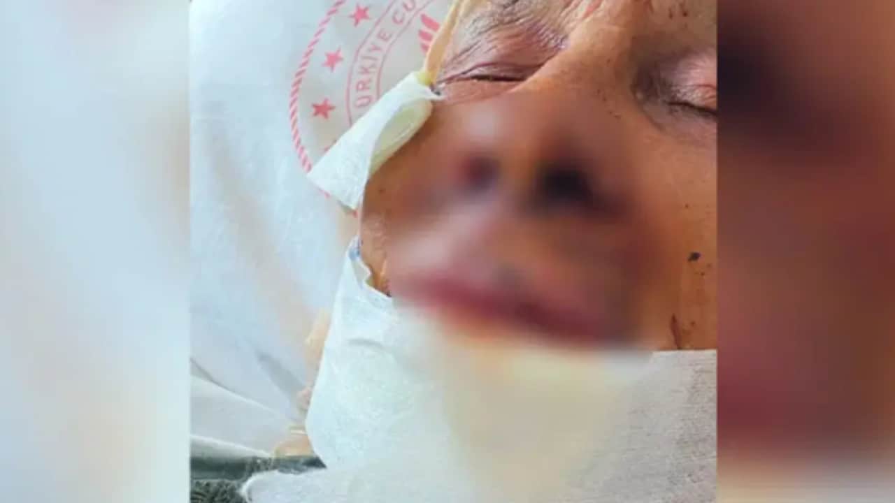 Foto - 85 yaşındaki kadını sopayla öldüresiye dövdü! Kadının durumu ağır!