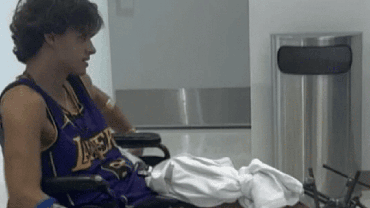 Foto - Bacağı ampute edilmişti: Survivor yarışmacısının son hali ortaya çıktı!