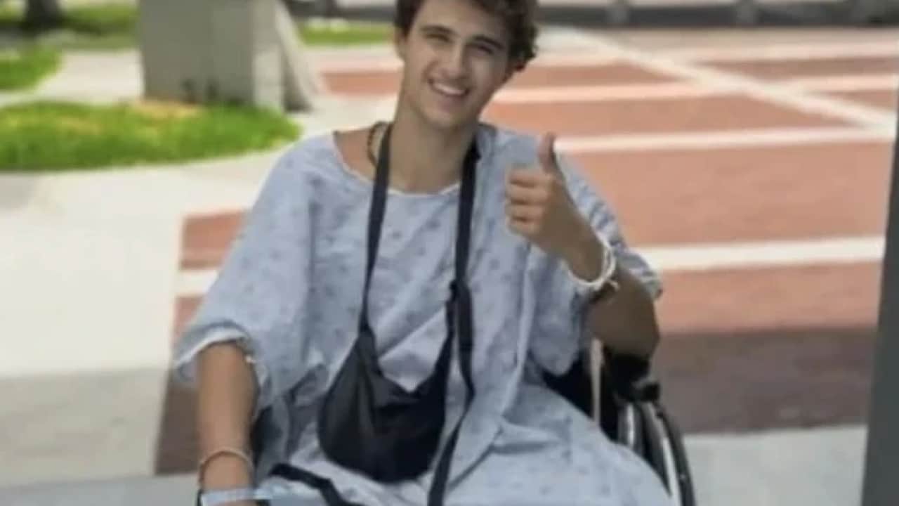Foto - Bacağı ampute edilmişti: Survivor yarışmacısının son hali ortaya çıktı!