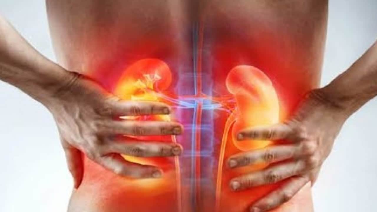 Foto - Böbrek taşı vakalarında dikkat çeken artış: Her 10 kişiden biri risk altında