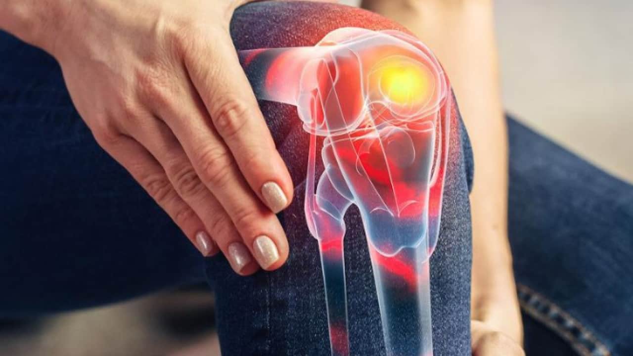 Foto - Canan Karatay dizdeki gizli tehlikeyi işaret etti! Ağrı kesici haplar çözüm değil