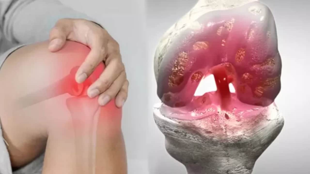 Foto - Canan Karatay dizdeki gizli tehlikeyi işaret etti! Ağrı kesici haplar çözüm değil