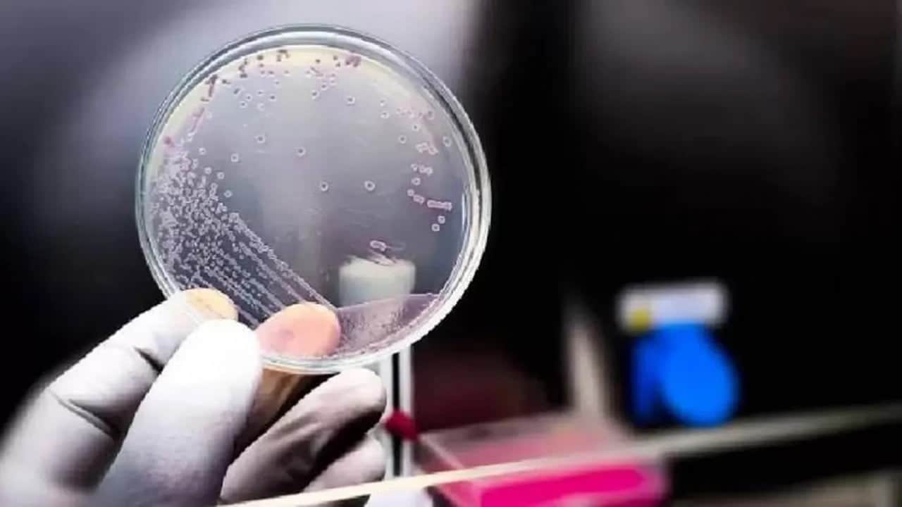 Foto - Doğada olmayanı üretti Yapay zeka virüsü laboratuvardan teknolojiye taşıdı
