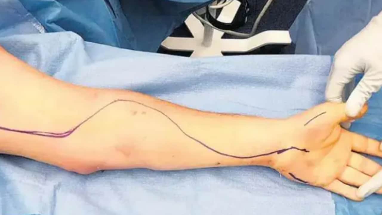 Foto - Eğer o işi yapıyorsanız erken emekli olabilirsiniz İşte kanser riski en yüksek meslek 